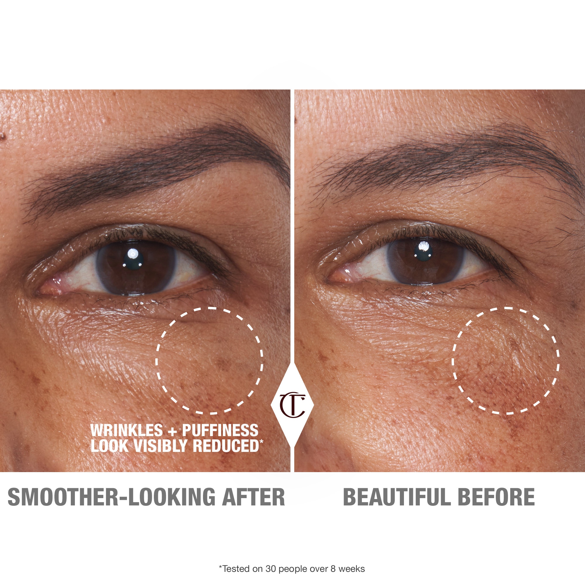 CRYO-RECOVERY EYE SERUM (SUERO PARA CONTORNO DE OJOS)